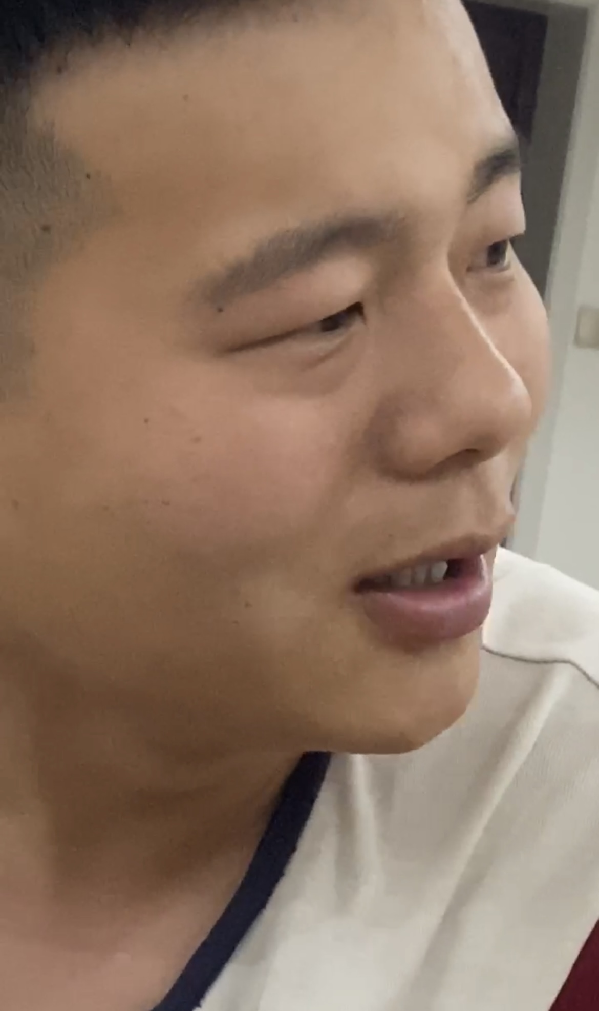 狗头2